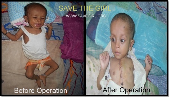 Preeti is Alive because of Our Supporters’s Help